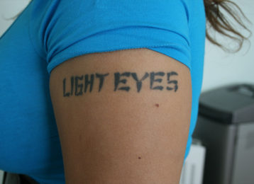 Laser tattoo removal female before 3