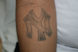 Laser tattoo removal male before 1