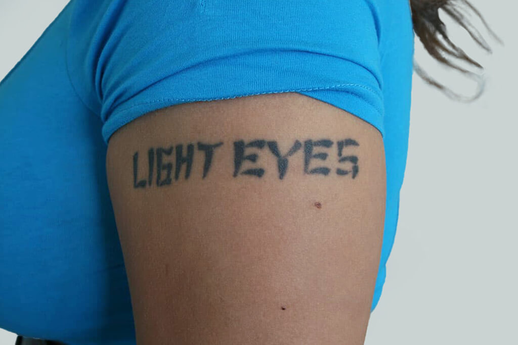Laser Tattoo Removal Lubbock TX | Unwanted Tattoo Removal Lubbock TX