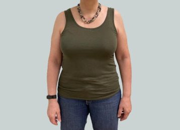 23858-medical-weightloss-full-body-before