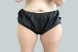 25846-coolsculpting-female-thighs-before