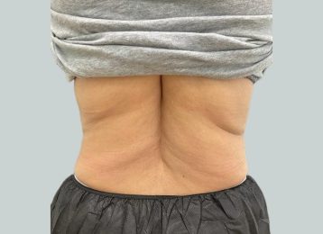 31202-medical-weight-loss-back-after