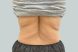 31202-medical-weight-loss-back-after