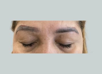 33909_LTR_eyebrows_before