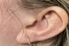 37474_LVR_ear_female_before