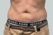 40421_coolsculpting-male-abdomen-after1