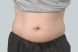 40421_coolsculpting-male-abdomen-before1