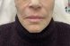 43170_instabalance_after adj